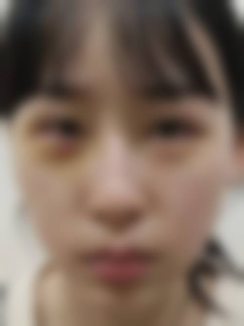 四、襄阳恩娜医疗美容诊所特色项目