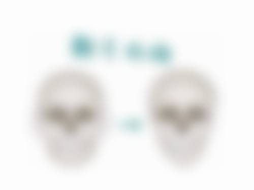 一、女人隆胸会有疤痕吗——常见的隆胸方式