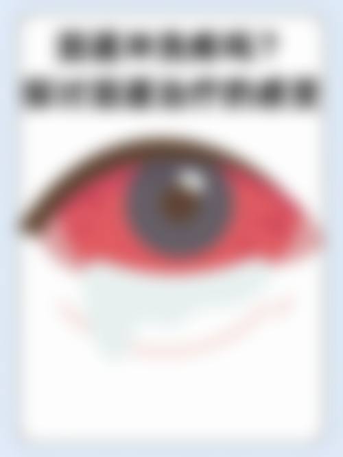 结语:选择正规眼科,守护清晰视界