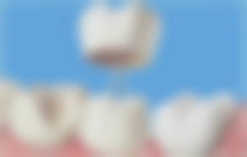 总结:选择映祥口腔,开启自信笑容