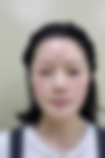 二、广州铂医昂方整形医院怎么样?
