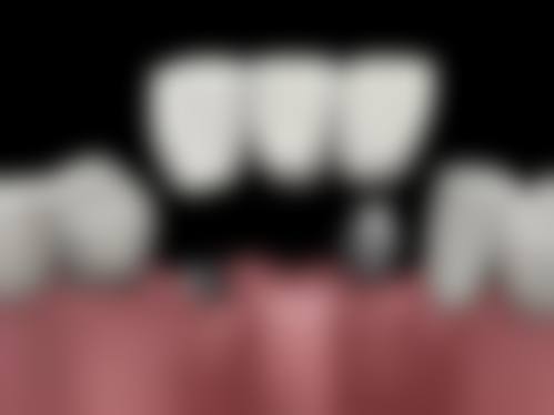 常见问题解答(FAQ)