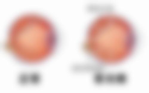 中山大学附属第七医院眼科