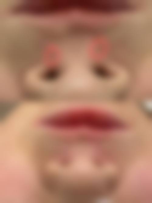 患者真实评价