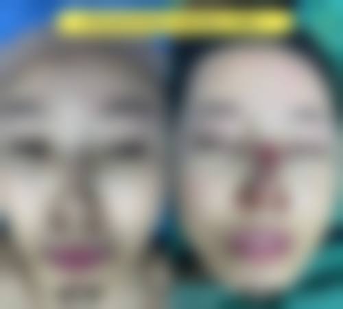 预约优惠活动