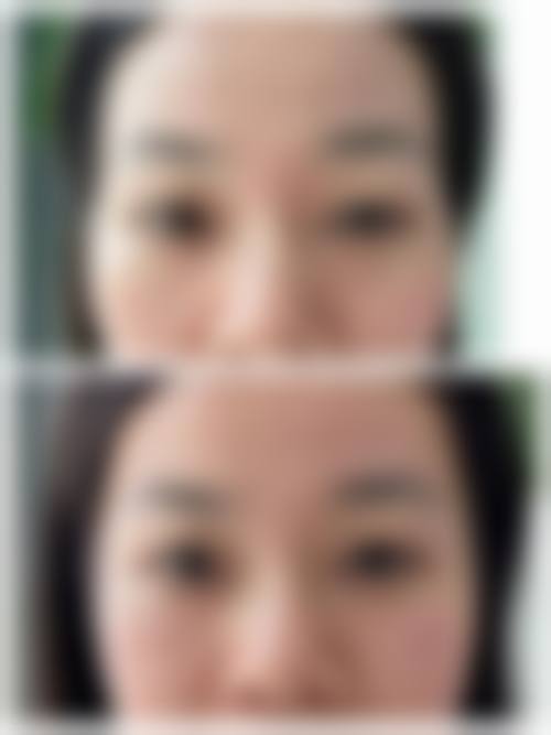八、沈阳和平胡筑医疗美容诊所真实的患者评价