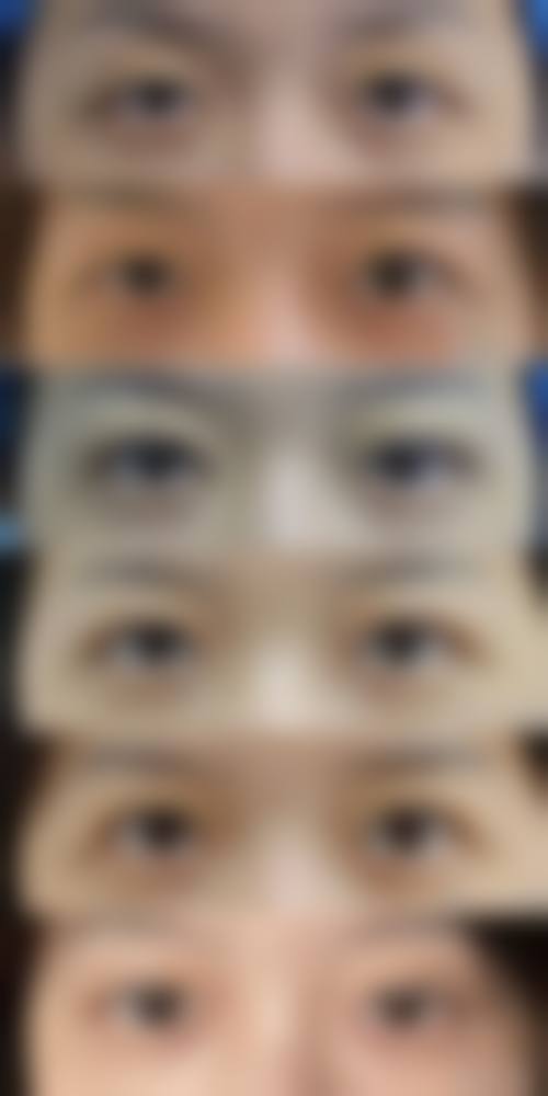 九、荆门刘永国整形医疗美容诊所真实的患者评价