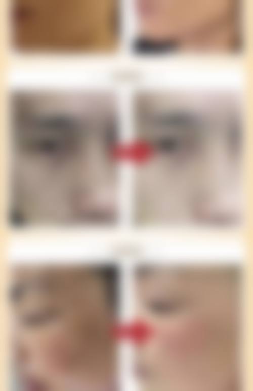 五、林晓曦怎么预约?