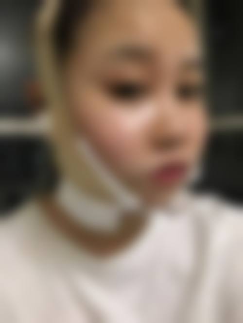 四、凉山艺佳美医疗美容诊所特色项目