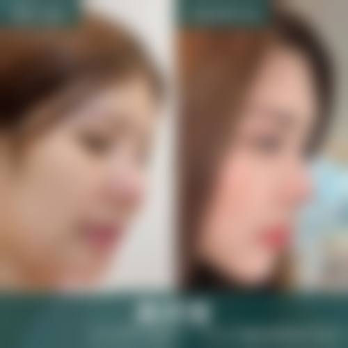 四、荆门刘永国整形医疗美容诊所特色项目