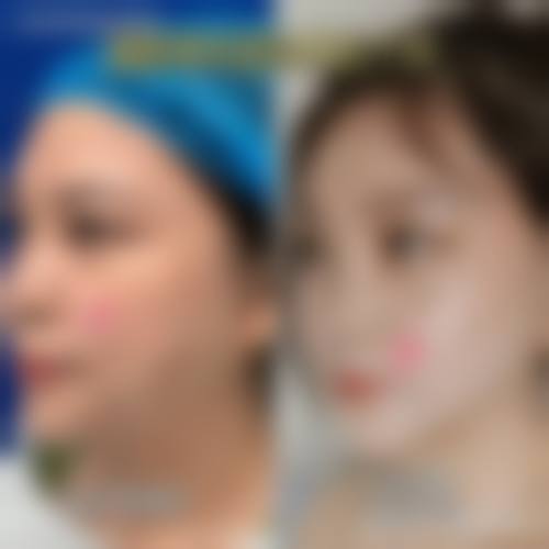 优惠活动详情：品质之美触手可及