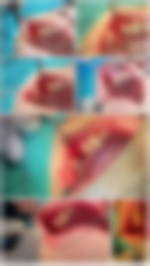 临床实例分享 西安西美口腔门诊部 黄丽娜 牙齿矫正