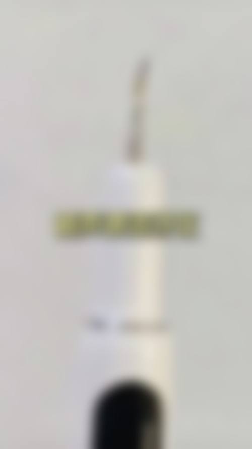 FAQ 黄丽娜 西安西美口腔门诊部 牙齿矫正