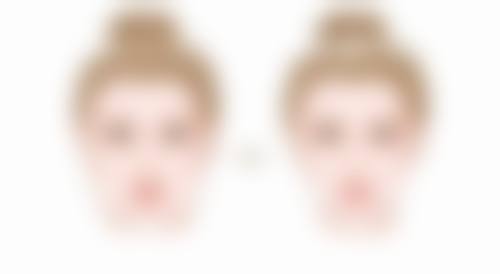 二、刚割双眼皮不能吃的药物