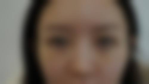 九、沈阳丽都美容医院真实的患者评价
