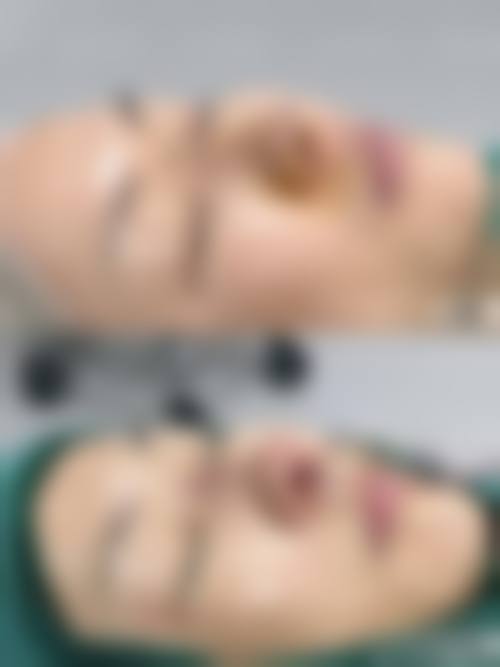 四、北京来美安医疗美容医院特色项目