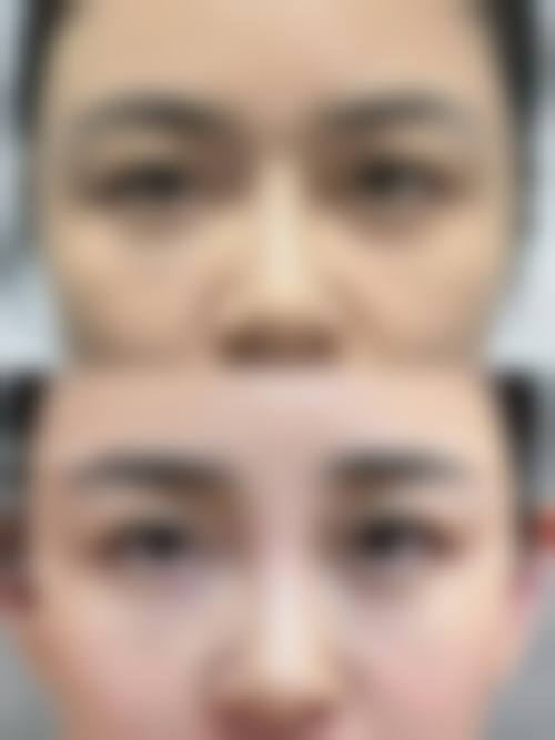 优惠活动详情