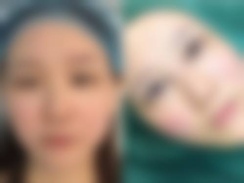 八、韩国狎鸥亭艾薇整形外科医院真实的患者评价