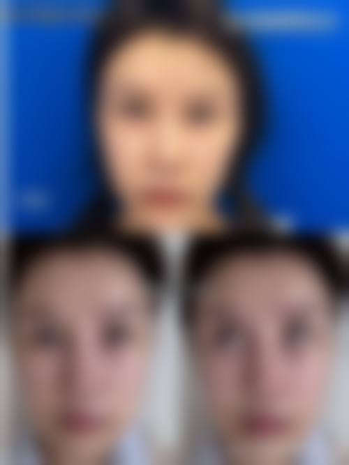 八、山东临沂美赉坞医疗美容预约方式