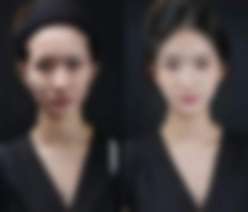 五、女人隆胸的好处与正确看待