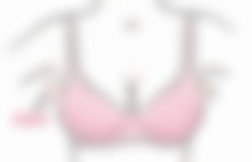五、肋骨隆鼻成效怎样——真实实例分享