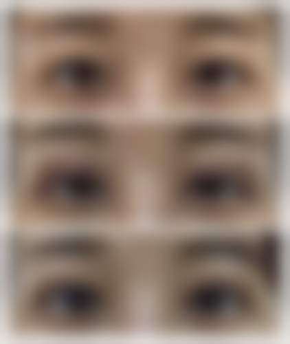 二、广州禾十昕整形医院怎么样?