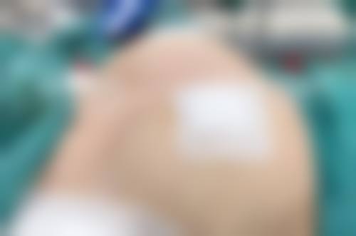 三、成都尊世慕华医疗美容门诊部诊疗项目有哪些?