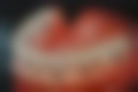 临床实例分享