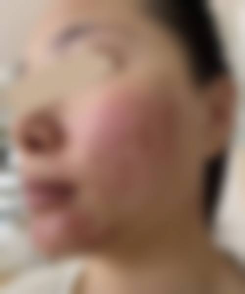 六、朱亚丽真实的患者评价