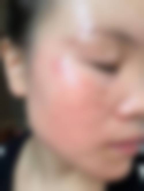 五、全仁基怎么预约?