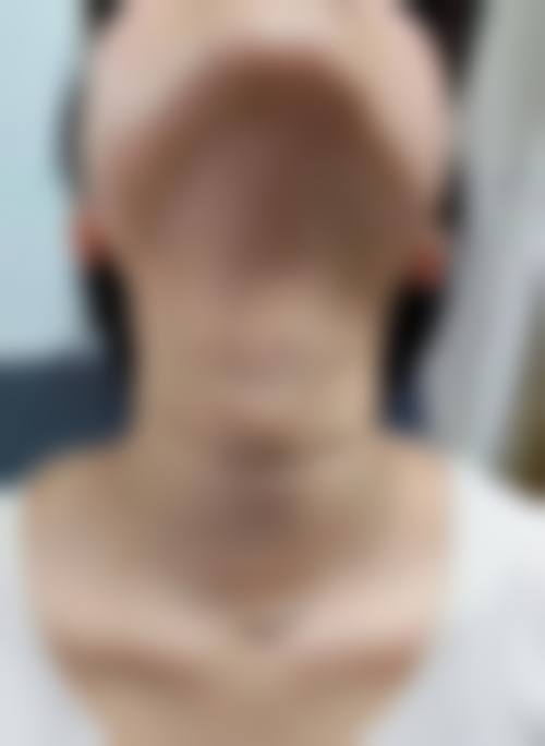 优惠活动与项目价格参考