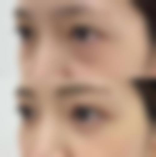 临床实例分享