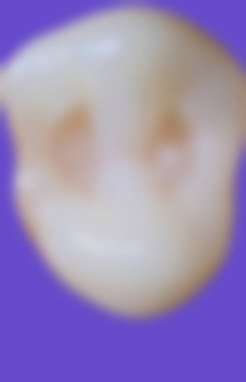 临床实例分享