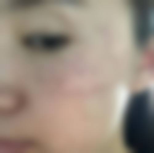 五、单继华怎么预约?