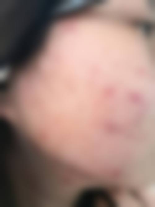 三、深圳市瑞鹏皮肤病专科门诊部诊疗项目有哪些?
