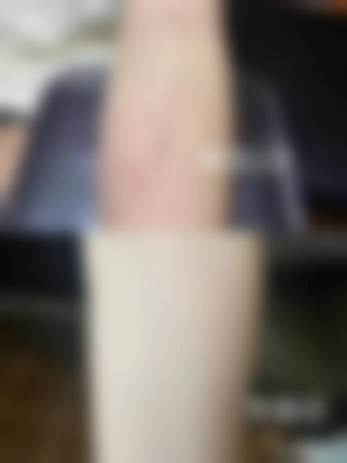 三、张岭岭技术优势