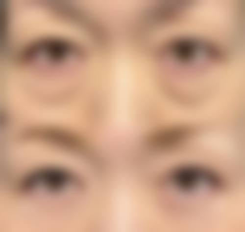 四、湖北省中医院整形美容科特色项目