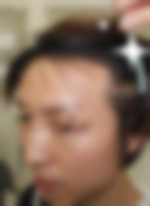 八、深圳市瑞鹏皮肤病专科门诊部真实的患者评价