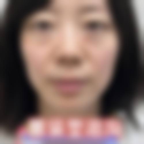 九、宁波海曙清媛医疗美容诊所真实的患者评价
