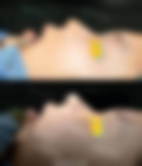 七、佛山医美恩整形医院预约方式