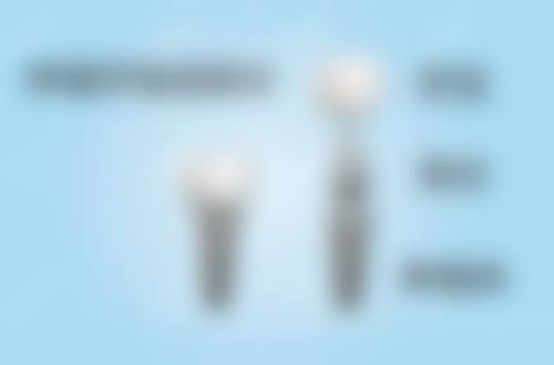 FAQ(常见问题解答)