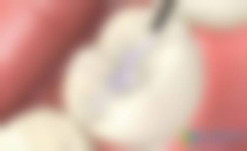 擅长项目详解