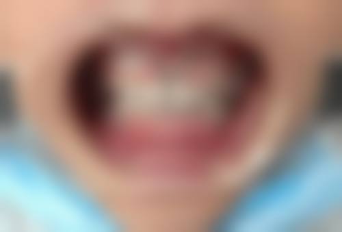 临床实例分享
