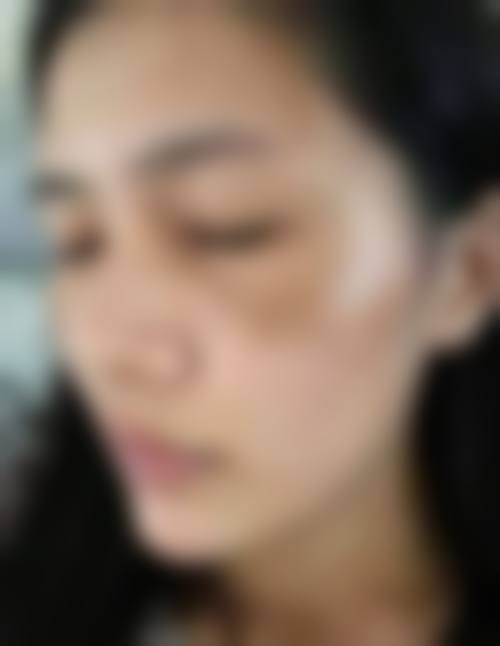 六、闵小勇真实的患者评价