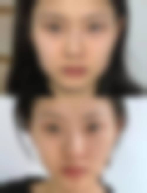 九、呼和浩特梦思整形医疗美容诊所真实的患者评价