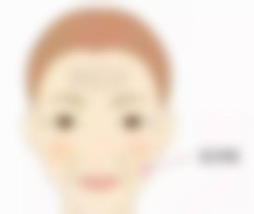 四、筋膜恒久无痕双眼皮的优势