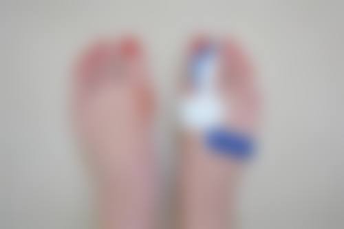 优惠活动详情——美丽触手可及