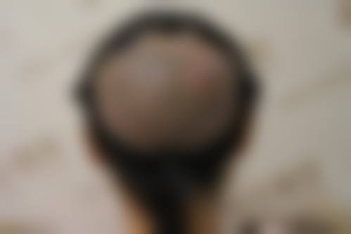 常见问题解答