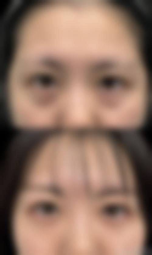 三、阳煤集团总医院烧伤整形科诊疗项目有哪些?