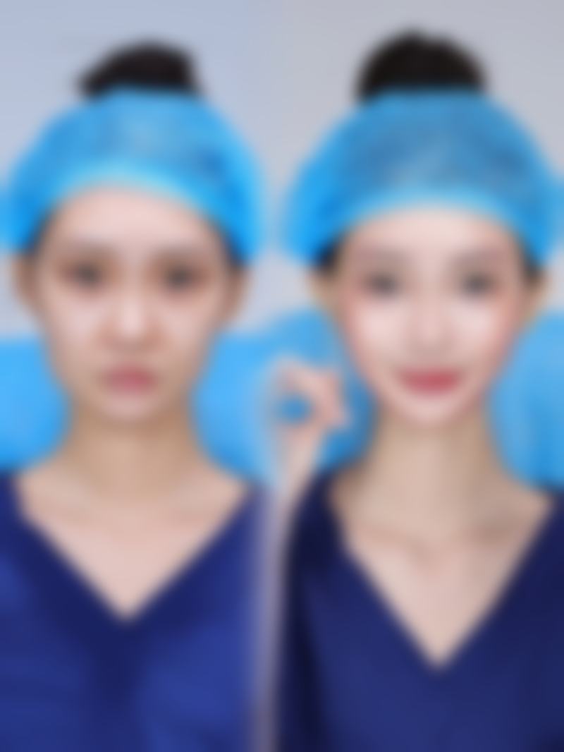 四、使用眼霜的小窍门